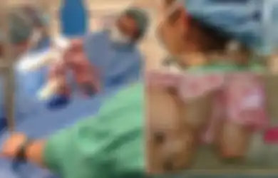 Sepasang Bayi Lahir dengan Berpegangan Tangan dan Tak Terpisahkan
