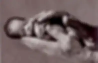 Hati-hati, Infeksi Bisa Menyebabkan Bayi Lahir Prematur