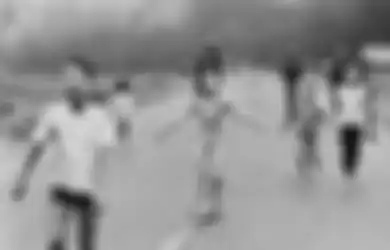 Cerita Kim Phuc, Gadis dalam Foto Ikonik Perang Vietnam Napalm Picture yang Mendapatkan Operasi Bedah Laser Gratis