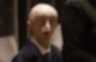 Berns, Pemuda dengan Penyakit Langka Meninggal Dunia