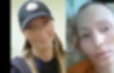 Kisah Polisi Wanita yang Meninggal Karena Tertular TBC dari Tersangka yang Meludahi Wajahnya