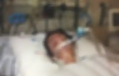 Menganggap Remeh Flu, Laura Spacagna Koma Selama Dua Tahun Akibat Komplikasi