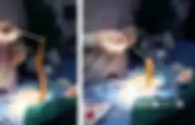 Dokter di China Temukan Belut Hidup di Perut Pasien, Ternyata Sengaja Dimasukkan Lewat Anus untuk Pengobatan Tradisional