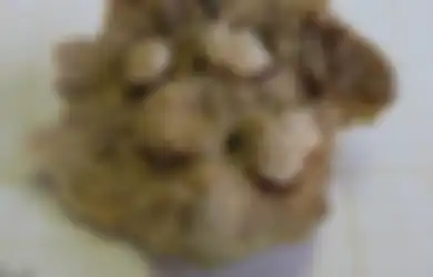 Misteri Lima Gigi yang ‘Terjebak’ dalam Tumor Ovarium para Kerangka Berusia 500 Tahun