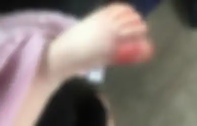Jangan Biarkan Anak Bermain di Pantai Tanpa Alas Kaki, Jika Tak Ingin Bernasib Malang Seperti Balita Ini!
