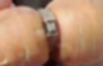 Kocak, Cincin Pertunangan yang Dikira Hilang 13 Tahun Lalu Ditemukan di Sebuah Wortel