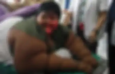 Arya Permana, Bocah Berbobot 189,5 Kg yang Gemar Konsumsi Mi Instan
