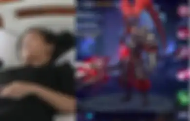 Peringatan Buat Semua Orang! Terlalu Sering Bermain Game Online, Salah Satu Mata Wanita Ini Alami Kebutaan