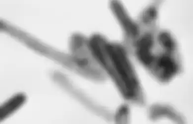 Sudah Tewaskan 3 Orang, Inilah Penjelasan Virus Marburg yang Mirip dengan Virus Ebola