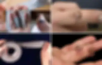 Wow! Cukup Dengan Lakban Kutil di Kulit Anda Akan Hilang, Bisa Dicoba Sekarang Juga 