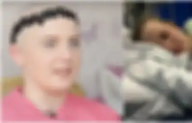 Kelainan Langka! Wanita Cantik Ini Idap Alergi Pada Segala Hal, Bahkan Air Mata Juga Rambutnya Sendiri