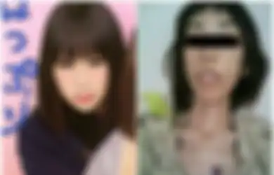 Selalu Disiksa Sang Kakek, Berat Badan Wanita Cantik Ini Sampai Tinggal 16,8 Kilogram