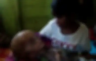 Setelah Menempuh Perjalanan Jauh, Bayi Penderita Hidrosefalus Ini Akhirnya Dirawat di Jakarta