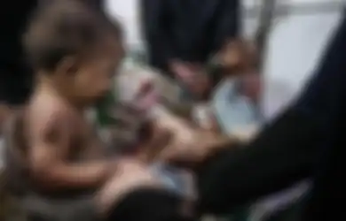 (Foto) Tragisnya Nasib Anak-anak yang Diserang Gas Beracun di Perang Suriah