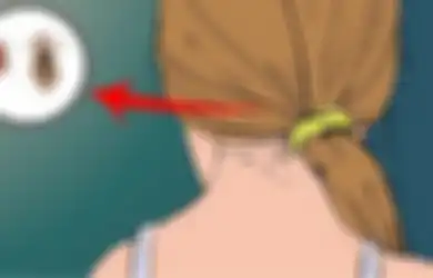 Jengkel dengan Kutu Rambut? Musnahkan dengan Bahan-bahan Alami Berikut
