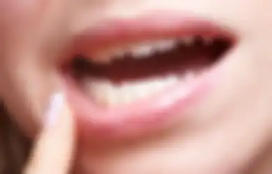 Hati-hati, 5 Penyakit Ini Bisa Menular Karena Ciuman, Berikut Gejala-gejalanya!