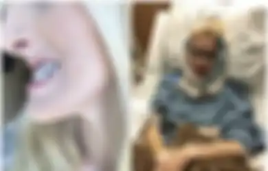 Jadi Korban Bully hingga Disebut Wajahnya Mirip Tukang Sihir, Gadis Ini Nekat Lakukan Operasi Plastik, Hasilnya Bikin Tercengang!