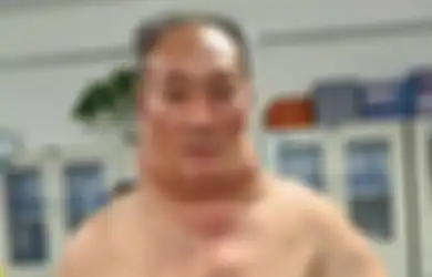 Kecanduan Berat Minum Minuman Penambah Stamina Membuat Pria ini Berubah Menjadi 'Hulk'