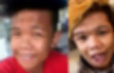 (Foto) Dibully 'Babang Tamvan' di Filipina, Pria Ini Putuskan Operasi Plastik, Hasilnya? Para Wanita Ngantre!