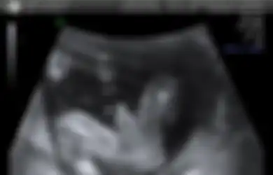 Janin pun Bisa Ereksi, Salah Satu Fakta tentang Penis yang Jarang Diketahui