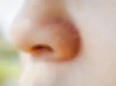 8 Cara Hilangkan Kulit Kering dan Bersisik di Area Hidung, Pasti Ampuh