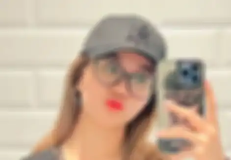 Mayang adik Vanessa Angel operasi hidung dan rela keluar duit Rp 50 juta, begini kondisinya sekarang.