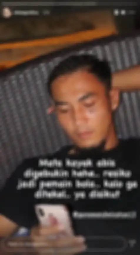Okie Agustina kabarkan kondisi miris sang suami yang wajahnya babak belur