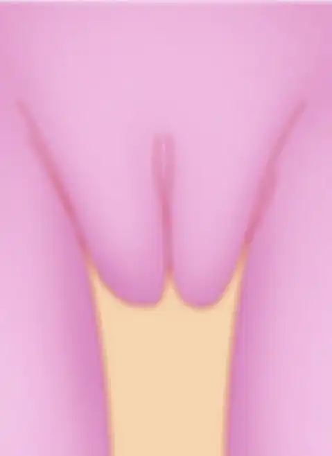 Tush tabirini: katta vagina