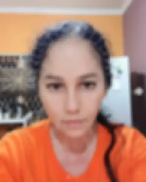 Meriam Bellina yang sedang menjalani akupunktur wajah