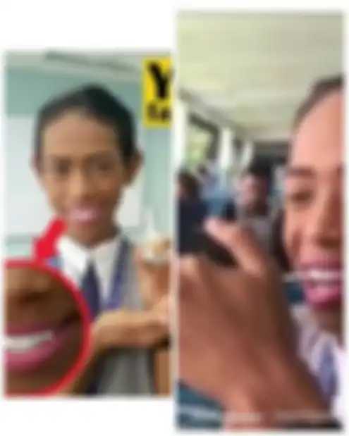 Hanya anak alay ini yang berani memutihkan gigi dengan kuteks. Berani coba?