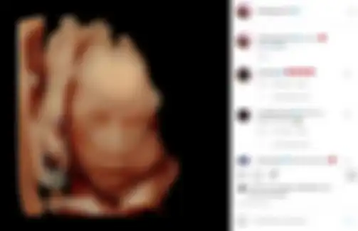 Potret calon anak kedua Raffi Ahmad dan Nagita Slavina 