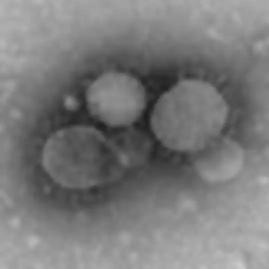 MERS-CoV