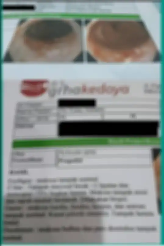 Hasil pemeriksaan pria yang sering makan mi instan setengah kardus dalam seminggu