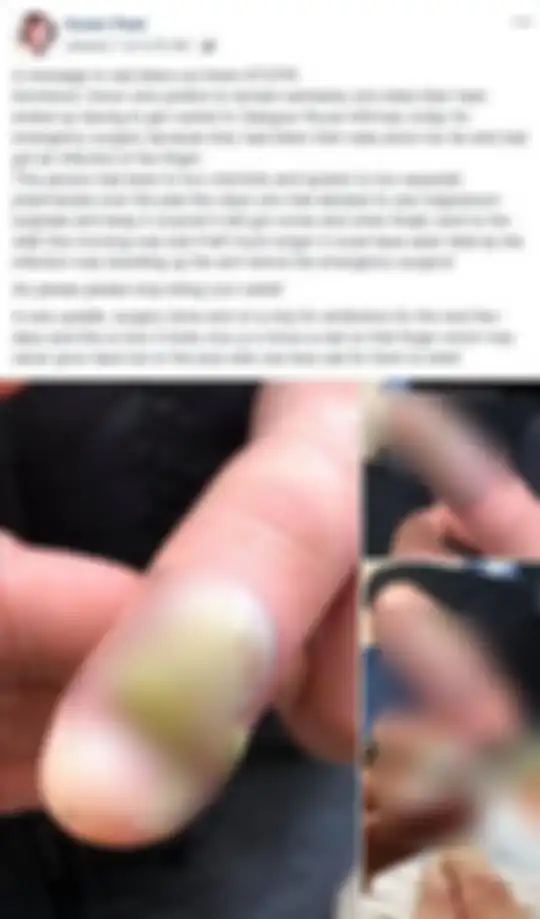 Cerita Karen soal jari temannya yang mengalami infeksi akibat kebiasaan menggigit kuku.
