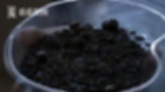 Tak Pernah Sarapan dan Jarang Minum, Wanita Tiongkok Ini Temukan 2000 Batu Empedu di Tubuhnya