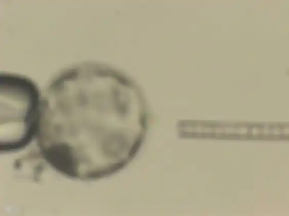 Injeksi sel manusia pada blastocyst babi.