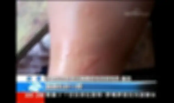 Dalam satu klip, seorang ilmuwan membahas digigit kelelawar