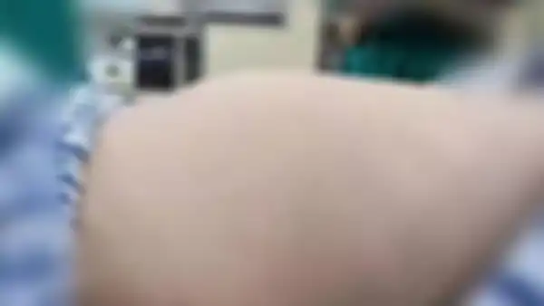 Perut Feifei membengkak.