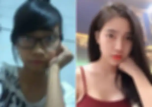 Tran Vu Van Anh, sebelum dan sesudah operasi