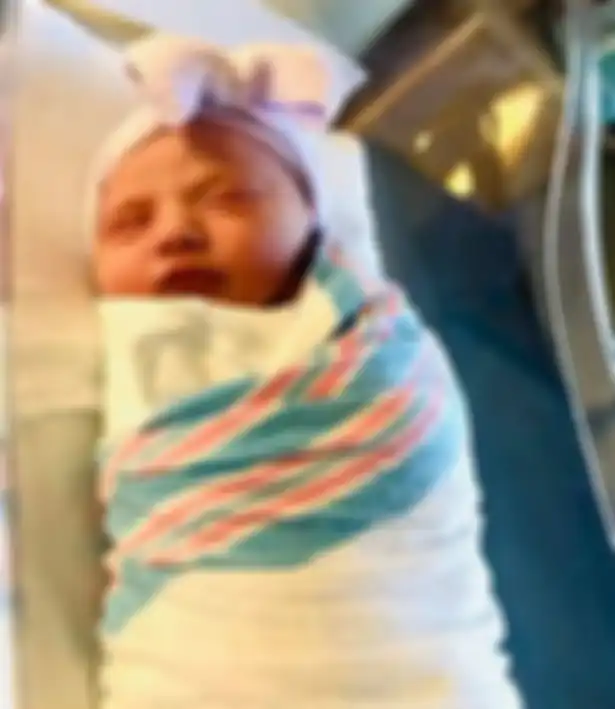 Bayi Shaylie menjalani perawatan untuk mengobati lukanya