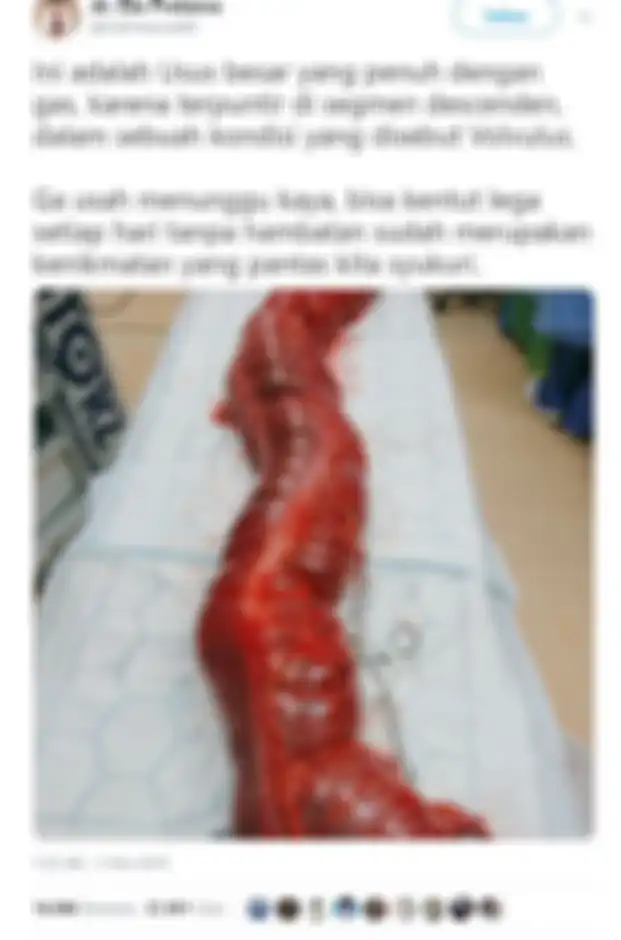 Unggahan dr. Gia yang mendapat perhatian netizen