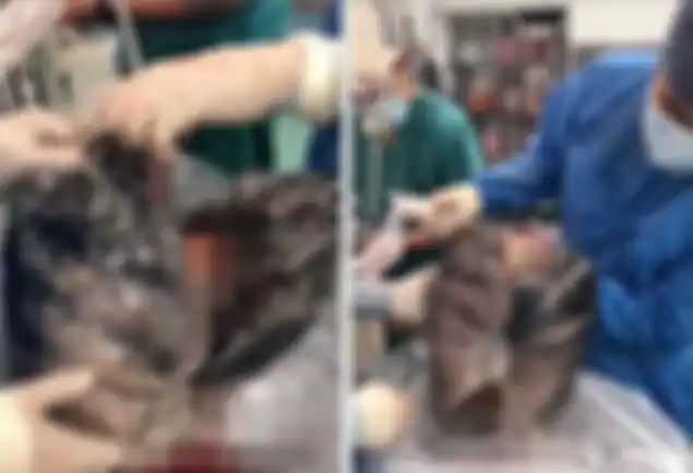 Kondisi jantung seorang perokok, setelah dokter mebedahnya.