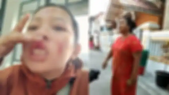 Viral, hanya karena tanya jatah sembako, wanita ini dihajar Bu RT hingga babak belur.