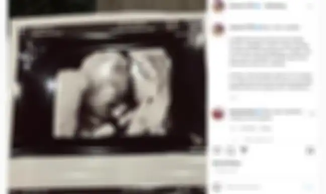 Ria Ricis mendadak minta maaf pada calon buah hatinya