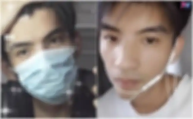 Penampakan wajahnya saat live steraming.