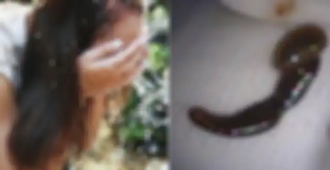 Mengerikan! Wanita Ini Menemukan Lintah Berukuran 5 Cm di Hidung Usai Membasuh Wajah dengan Aliran Air di Gunung