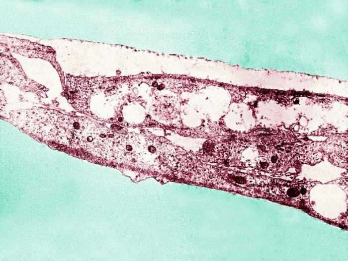 Treponema pallidum.