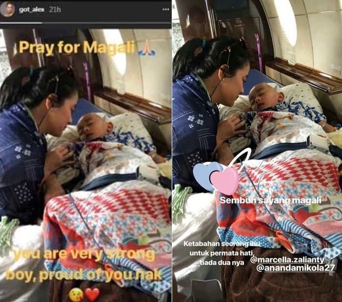 Anak Marcella Zalianty Alami Kanker Otak