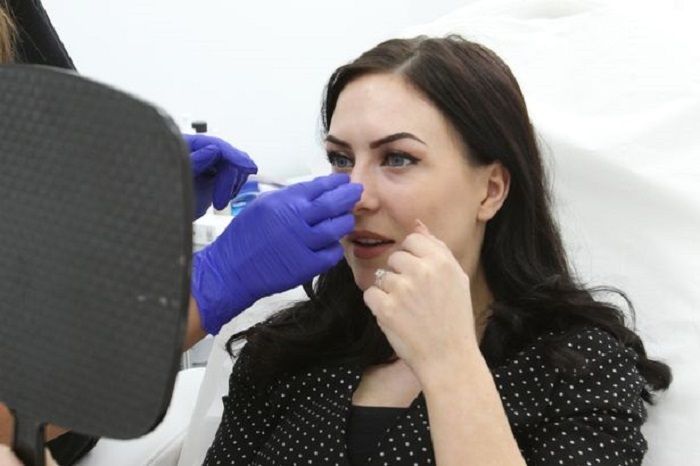 Sophie melakukan perubahan pada hidungnya