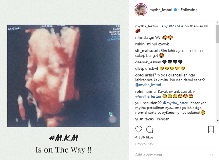 Foto hasil USG Mytha Lestari.